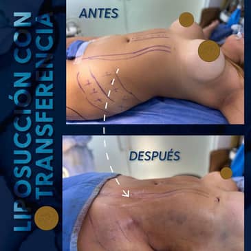 Slider image (4) Dr. Eduardo Cartagena Plastic and Reconstructive Surgeon